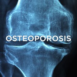 osteoporosis